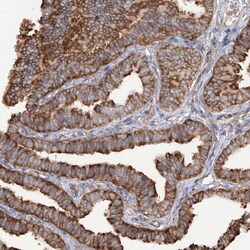 RPS25 Antibody, Novus Biologicals 25ul | Buy Online | Novus Biologicals | Fisher Scientific